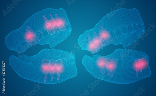 human jaw. 3d vector layout. medicine and health. pain teeth.