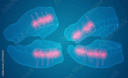 human jaw. 3d vector layout. medicine and health. pain teeth.