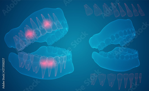 human jaw. 3d vector layout. medicine and health. pain teeth.