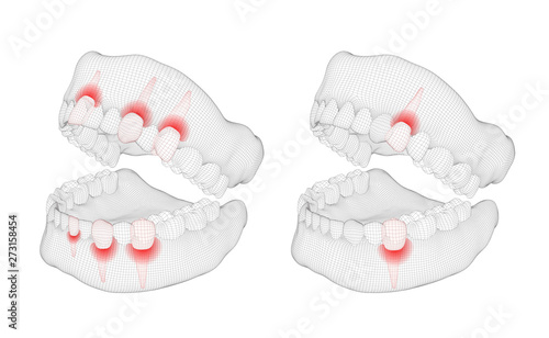 human jaw. 3d vector layout. medicine and health. pain teeth.