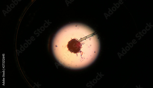 Vista de un hongo desde un microscopio. 