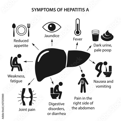 Symptoms of Hepatitis A 