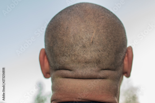 man with head