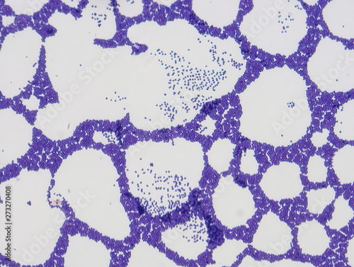 Microbiological microscope photograph