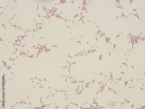 Microbiological microscope photograph