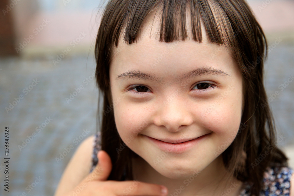 Cute smiling down syndrome girl on the blue background Cute smiling down syndrome girl on the blue background