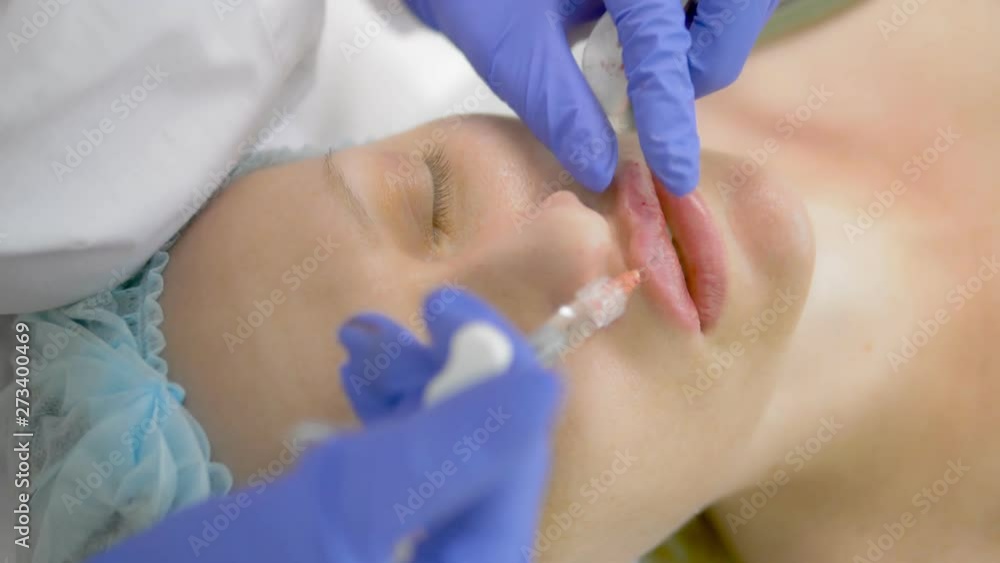 Lip injection, operation to increase the volume of the lips. doctor cosmetologist makes contouring plastic to increase the lips Lip injection, operation to increase the volume of the lips. doctor cosmetologist makes contouring plastic to increase the lips