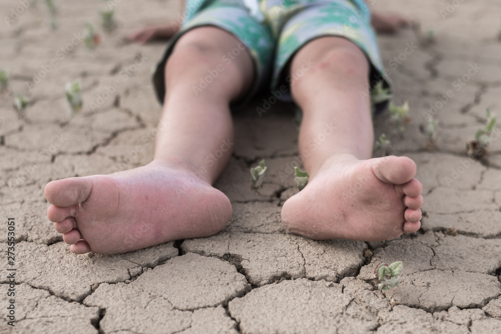 Fainting from heat, dehydration in a child. Children's feet lie on