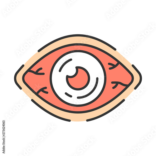 Allergic conjunctivitis vector color icon
