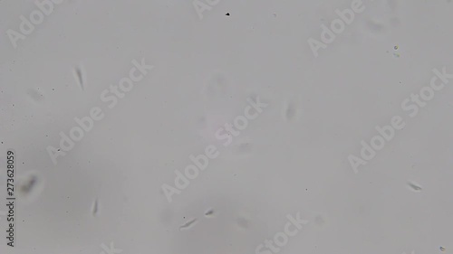 Trypanosoma cruzi microscope view; human diseases photo