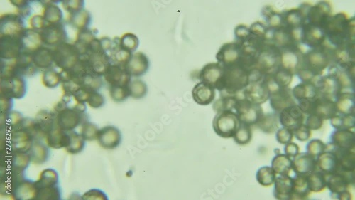 Trypanosoma cruzi microscope view; human diseases