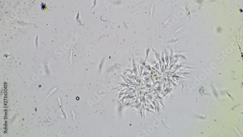 Trypanosoma cruzi microscope view; human diseases