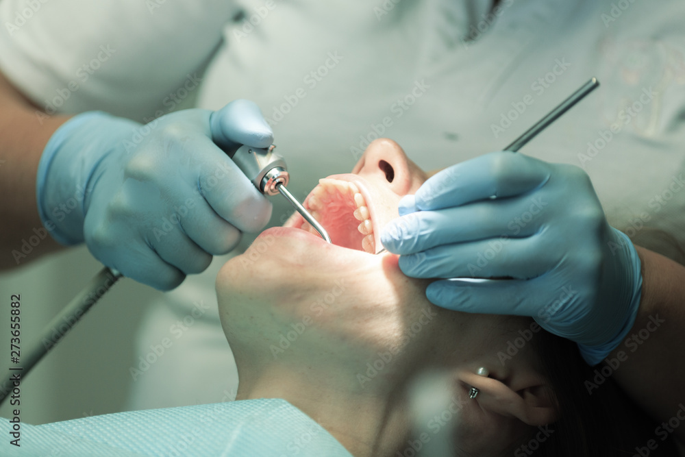 Close-up medical dentist procedure of teeth cleaning Close-up medical dentist procedure of teeth cleaning