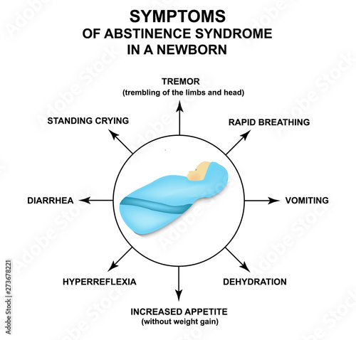 Symptoms of abstinence syndrome in newborns. Infographics. withdrawal syndrome in infants. Vector illustration on isolated background.