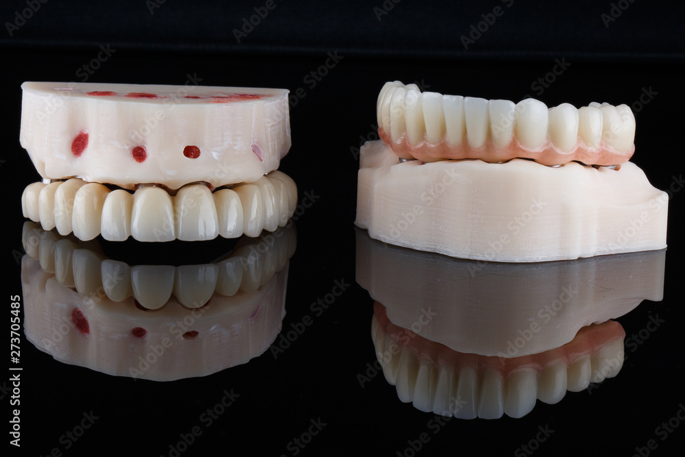 two dental prosthesis with a beautiful artificial gum on a black mirror and reflection two dental prosthesis with a beautiful artificial gum on a black mirror and reflection