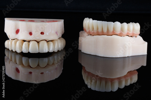 two dental prosthesis with a beautiful artificial gum on a black mirror and reflection