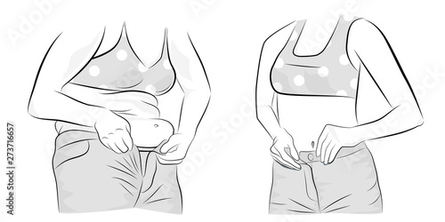 woman before and after losing weight. vector illustration.