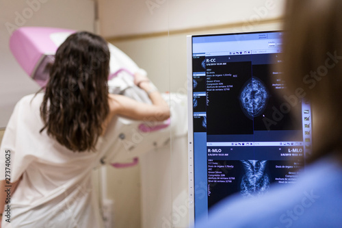 Female patient beside digital mammography unit photo