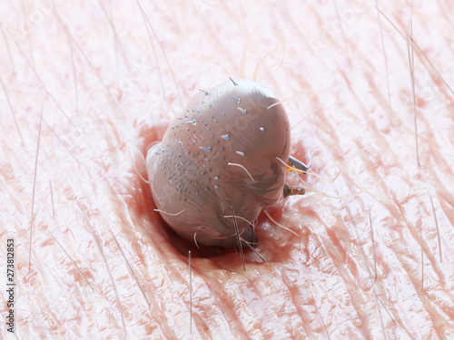 3d rendered medically accurate illustration of a scabies mite in human skin photo