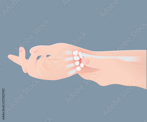 wrist bones injury white background wrist pain