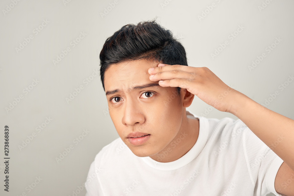 Young man struggling with acne on his face caring for his skin pushes acne