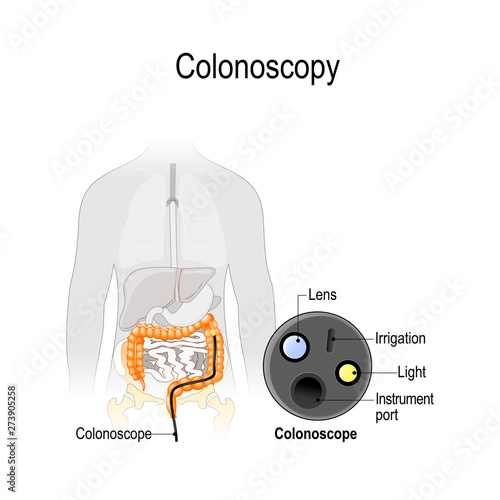 colonoscopy in the colon. Silhouette of the man with the colon and close-up of endoscope.