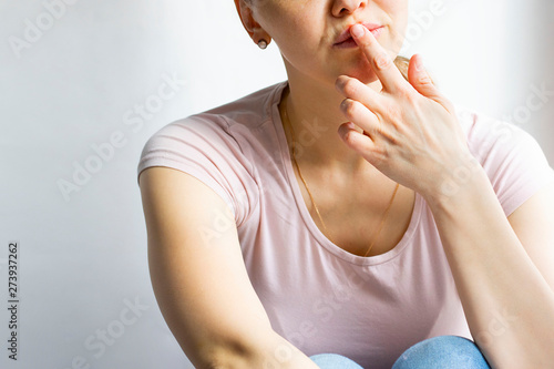 Red bubbles of virus herpes on lips of a woman in light pink t-shirt, lower part face is seen, which she touches with her finger. Medicine, treatment. Horizontal with copy space. White grey background photo