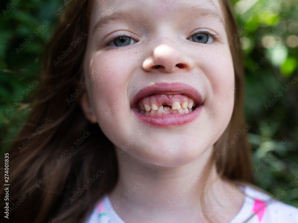 portrait of a little cute toothless girl portrait of a little cute toothless girl