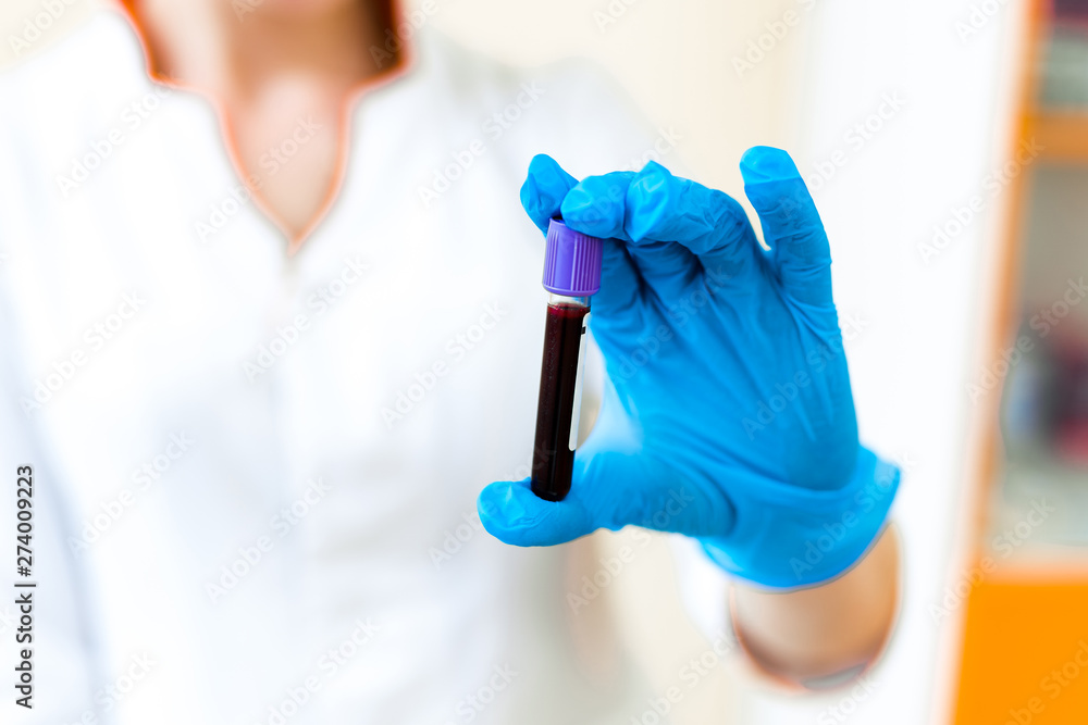 Testing blood sample in the hand of a female technician in the laboratory. Woman's hand in protective blue glove is holding a small vial of blood on the blurred background. Testing blood sample in the hand of a female technician in the laboratory. Woman's hand in protective blue glove is holding a small vial of blood on the blurred background.