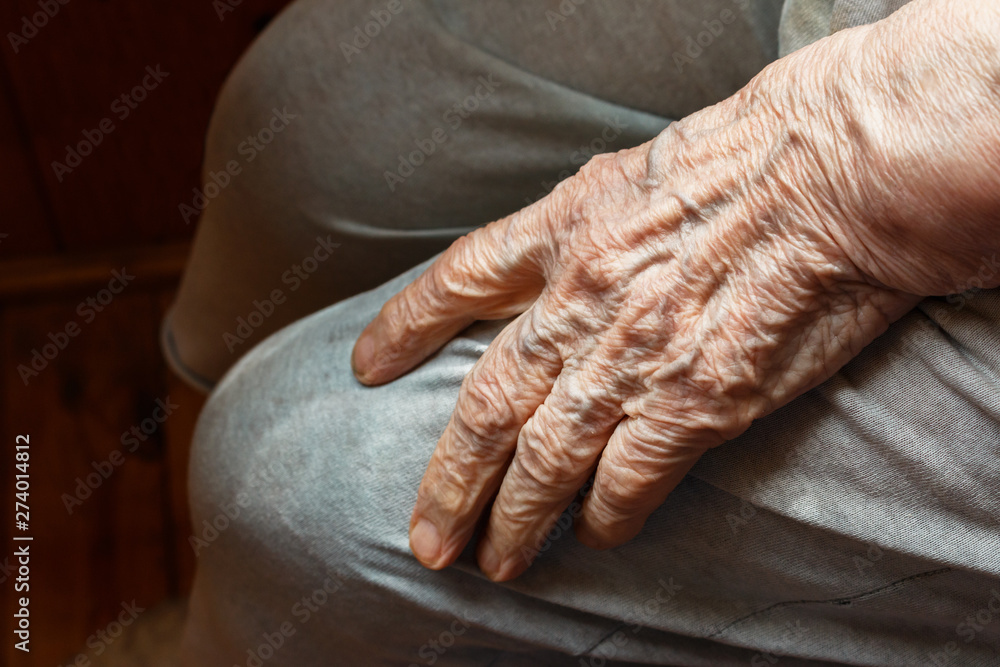 Fototapeta premium old woman's wrinkled palm with clearly visible veins lying on her knee, close-up. protection and care for the elderly.