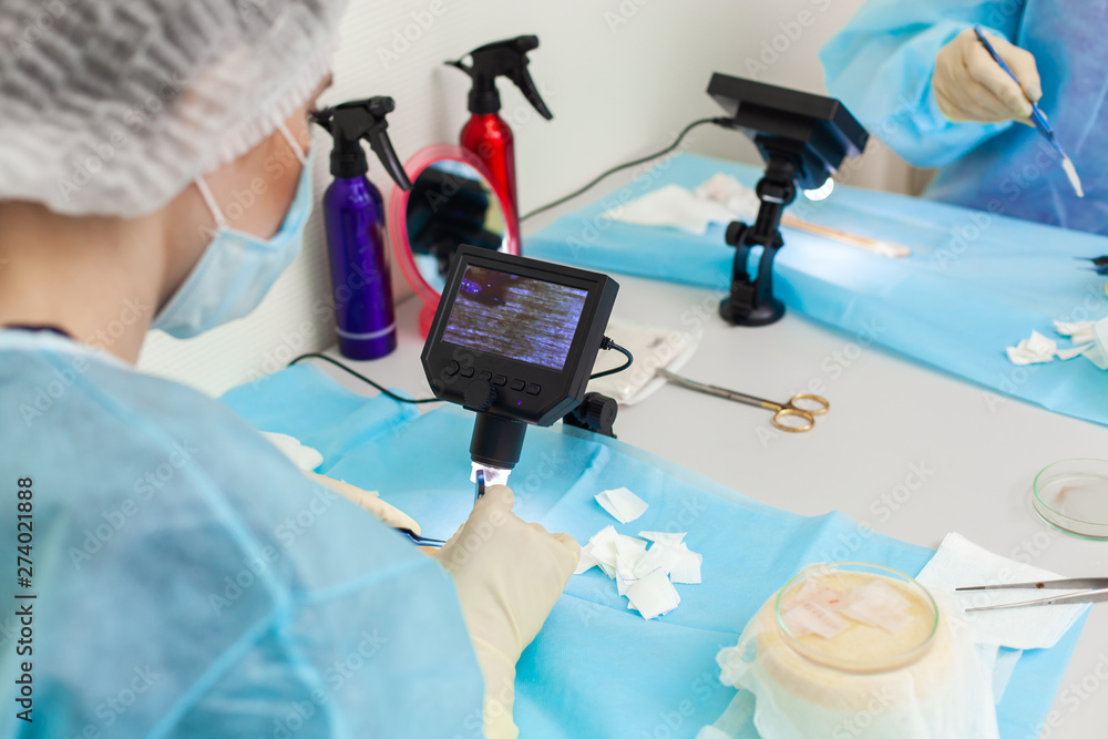 Φωτογραφία The doctor under the microscope recalculates the hair follicles
