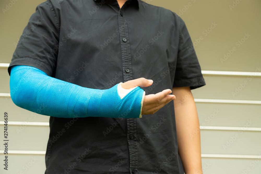 Broken hand injury, Asian man with hand operation with pressure bandage in hospital building.
