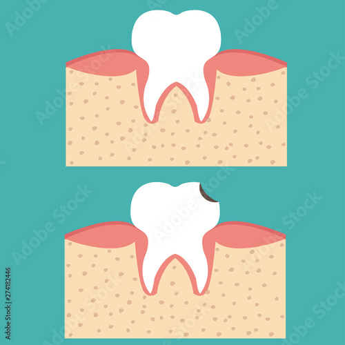 Sectional view tooth