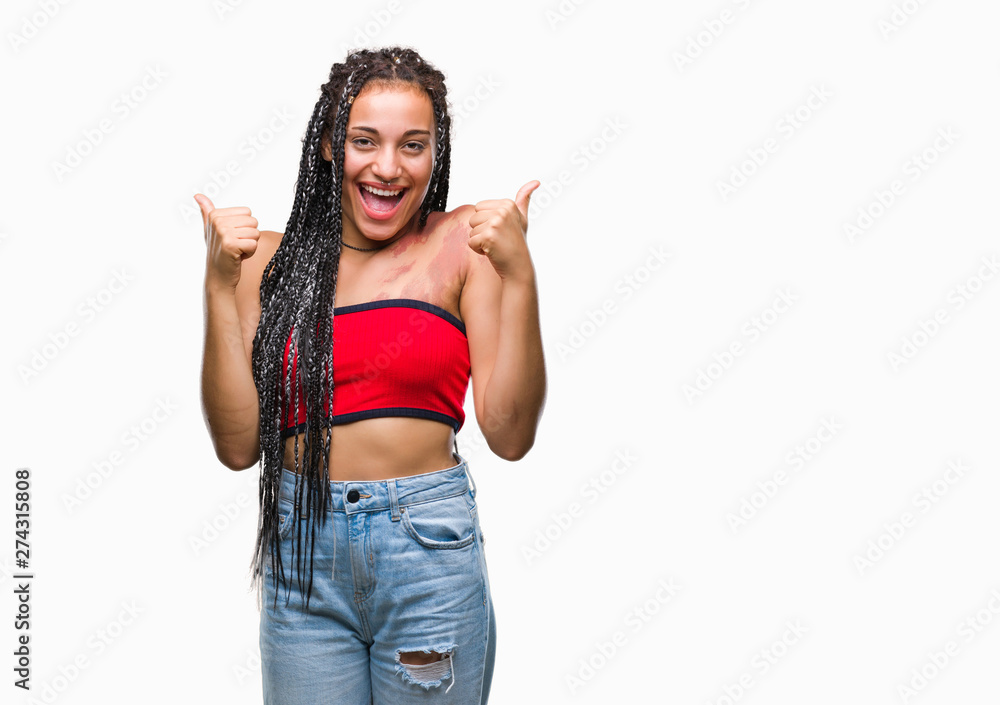Young braided hair african american with pigmentation blemish birth mark over isolated background success sign doing positive gesture with hand, thumbs up smiling and happy. Looking at the camera Young braided hair african american with pigmentation blemish birth mark over isolated background success sign doing positive gesture with hand, thumbs up smiling and happy. Looking at the camera