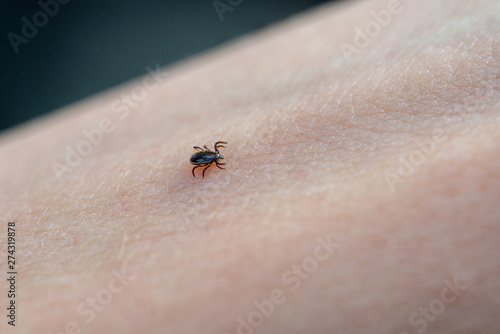 Tick on human skin