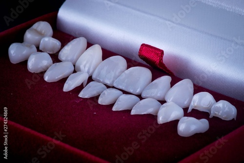 dental veneers and crowns