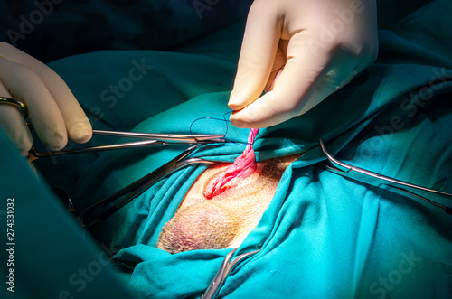 Ligation of the vas deferens and its vessels