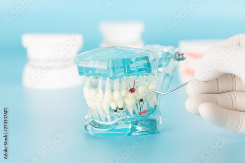 Fotografie Dental tool with model in dental care concept.