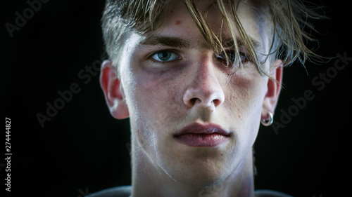 Tablou pe pânză Close-up Portrait Shot of a Drug Addict Suffering Young Boy Sadly Looking into the Camera