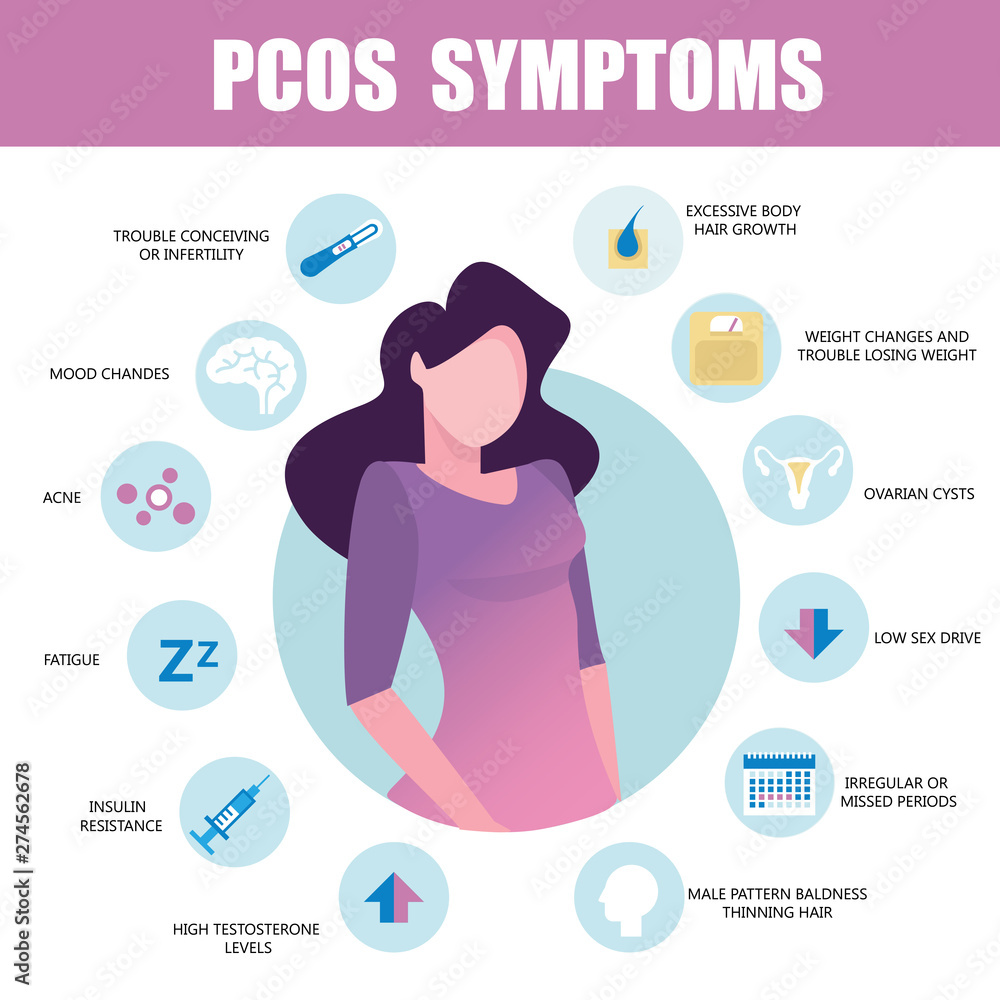 PCOS Symptoms Infographic Detailed Vector Infographic Women Health 