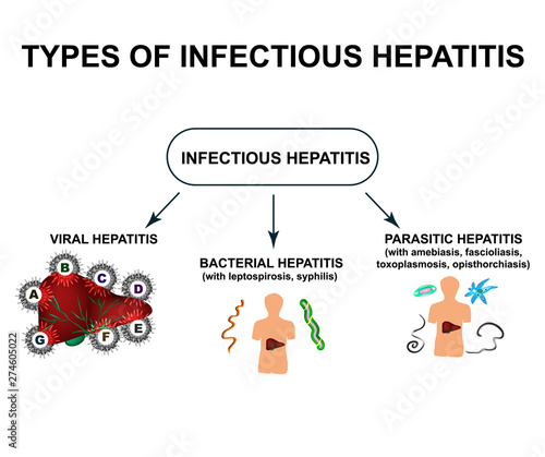 Types of viral hepatitis. Hepatitis A, B, C, D, E, F, G. World Hepatitis Day. Infographics. Vector illustration on isolated background.
