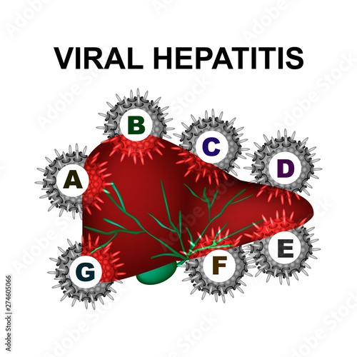 Types of viral hepatitis. Hepatitis A, B, C, D, E, F, G. World Hepatitis Day. Infographics. Vector illustration on isolated background.