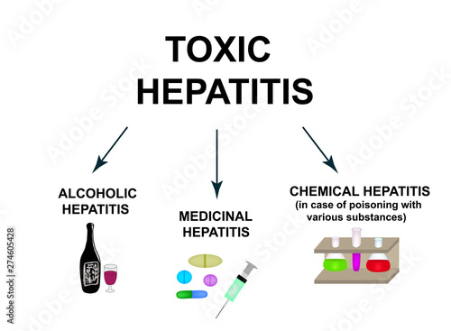 Types of Toxic hepatitis. Classification of Hepatitis A, B, C, D, E, F, G. Toxic, alcoholic, medicinal hepatitis. World Hepatitis Day. Infographics. Vector illustration