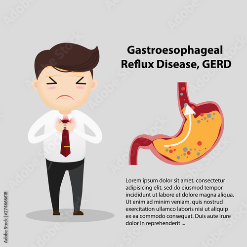 Gastro-Esophageal Reflux Disease (GERD)