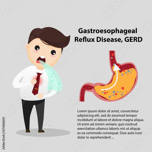 Gastro-Esophageal Reflux Disease (GERD)