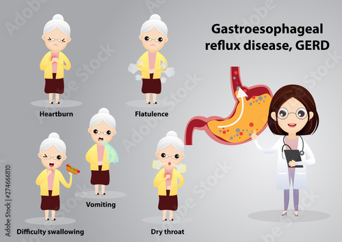 Gastro-Esophageal Reflux Disease (GERD)