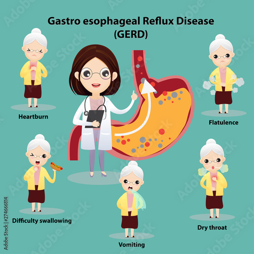 Gastro-Esophageal Reflux Disease (GERD)