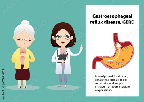 Gastro-Esophageal Reflux Disease (GERD)