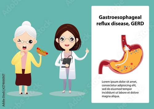 Gastro-Esophageal Reflux Disease (GERD)
