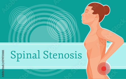 Spinal stenosis pain body. Cause of pain human body.